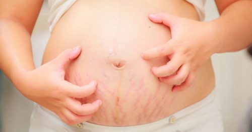 Những thay đổi về da và cách chăm sóc khi mang thai, mẹ nào cũng cần biết