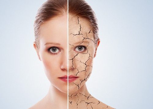 Da mặt bị khô nguyên nhân và cách ngăn ngừa hiệu quả nhất