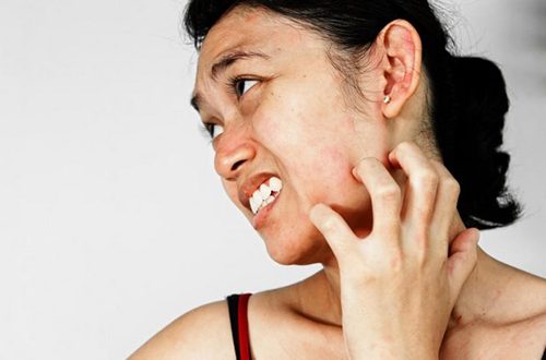 Da mặt bị khô sần và ngứa làm thế nào khắc phục hiệu quả nhất?