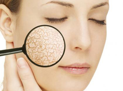 Da mặt bị kho thường bị lão hóa nhanh