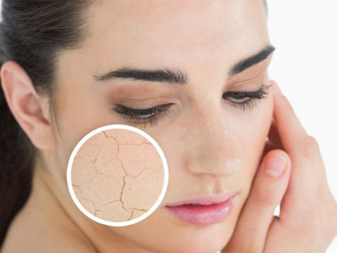 Cách chăm sóc da mặt khô nên chú trọng dưỡng ẩm cho da