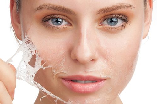Liệu pháp thiên nhiên giúp khắc phục da mặt khô tróc vảy